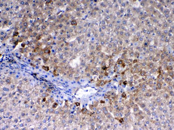 IHC analysis of CD105 using anti-CD105 antibody (A02997-2). CD105 was detected in paraffin-embedded section of rat liver tissue. Heat mediated antigen retrieval was performed in citrate buffer (pH6, epitope retrieval solution) for 20 mins. The tissue section was blocked with 10% goat serum. The tissue section was then incubated with 1ug/ml rabbit anti-CD105 Antibody (A02997-2) overnight at 4 Biotinylated goat anti-rabbit IgG was used as secondary antibody and incubated for 30 minutes at 37 The tissue section was developed using Strepavidin-Biotin-Complex (SABC)(Catalog # SA1022) with DAB as the chromogen.