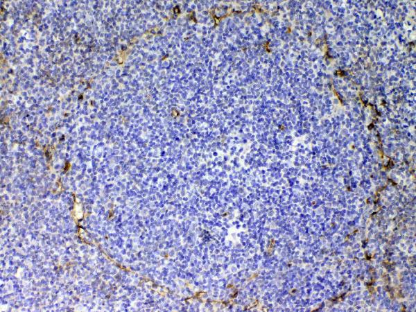 IHC analysis of CD105 using anti-CD105 antibody (A02997-2). CD105 was detected in paraffin-embedded section of rat spleen tissue. Heat mediated antigen retrieval was performed in citrate buffer (pH6, epitope retrieval solution) for 20 mins. The tissue section was blocked with 10% goat serum. The tissue section was then incubated with 1ug/ml rabbit anti-CD105 Antibody (A02997-2) overnight at 4 Biotinylated goat anti-rabbit IgG was used as secondary antibody and incubated for 30 minutes at 37 The tissue section was developed using Strepavidin-Biotin-Complex (SABC)(Catalog # SA1022) with DAB as the chromogen.