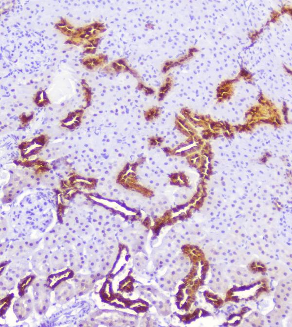 IHC analysis of Calbindin using anti-Calbindin antibody (A03047). Calbindin was detected in paraffin-embedded section of rat kidney tissue. Heat mediated antigen retrieval was performed in citrate buffer (pH6, epitope retrieval solution) for 20 mins. The tissue section was blocked with 10% goat serum. The tissue section was then incubated with 1μg/ml rabbit anti-Calbindin Antibody (A03047) overnight at 4°C. Biotinylated goat anti-rabbit IgG was used as secondary antibody and incubated for 30 minutes at 37°C. The tissue section was developed using Strepavidin-Biotin-Complex (SABC)(Catalog # SA1022) with DAB as the chromogen.
