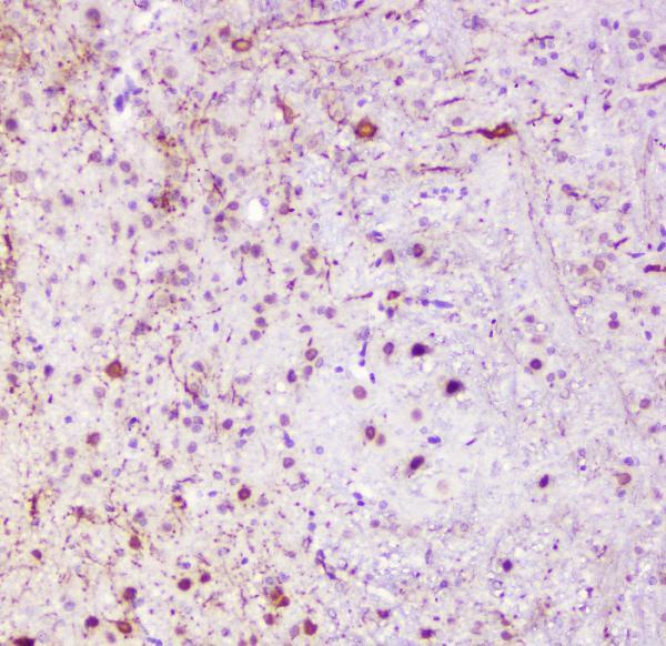 IHC analysis of Calbindin using anti-Calbindin antibody (A03047). Calbindin was detected in paraffin-embedded section of mouse brain tissue. Heat mediated antigen retrieval was performed in citrate buffer (pH6, epitope retrieval solution) for 20 mins. The tissue section was blocked with 10% goat serum. The tissue section was then incubated with 1μg/ml rabbit anti-Calbindin Antibody (A03047) overnight at 4°C. Biotinylated goat anti-rabbit IgG was used as secondary antibody and incubated for 30 minutes at 37°C. The tissue section was developed using Strepavidin-Biotin-Complex (SABC)(Catalog # SA1022) with DAB as the chromogen.