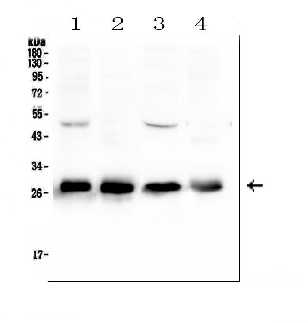 Western blot analysis of Calbindin using anti-Calbindin antibody (A03047). Electrophoresis was performed on a 5-20% SDS-PAGE gel at 70V (Stacking gel) / 90V (Resolving gel) for 2-3 hours. The sample well of each lane was loaded with 50ug of sample under reducing conditions. Lane 1: rat brain tissue lysates, Lane 2: rat kidney tissue lysates, Lane 3: mouse brain tissue lysates, Lane 4: mouse kidney tissue lysates. After Electrophoresis, proteins were transferred to a Nitrocellulose membrane at 150mA for 50-90 minutes. Blocked the membrane with 5% Non-fat Milk/ TBS for 1.5 hour at RT. The membrane was incubated with rabbit anti-Calbindin antigen affinity purified polyclonal antibody (Catalog # A03047) at 0.5 μg/mL overnight at 4°C, then washed with TBS-0.1%Tween 3 times with 5 minutes each and probed with a goat anti-rabbit IgG-HRP secondary antibody at a dilution of 1:10000 for 1.5 hour at RT. The signal is developed using an Enhanced Chemiluminescent detection (ECL) kit (Catalog # EK1002) with Tanon 5200 system. A specific band was detected for Calbindin at approximately 28KD. The expected band size for Calbindin is at 30KD.