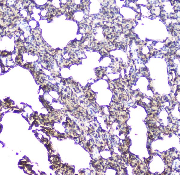 IHC analysis of Aquaporin 5 using anti-Aquaporin 5 antibody (A03085). Aquaporin 5 was detected in paraffin-embedded section of rat lung tissue. Heat mediated antigen retrieval was performed in citrate buffer (pH6, epitope retrieval solution) for 20 mins. The tissue section was blocked with 10% goat serum. The tissue section was then incubated with 2μg/ml rabbit anti-Aquaporin 5 Antibody (A03085) overnight at 4°C. Biotinylated goat anti-rabbit IgG was used as secondary antibody and incubated for 30 minutes at 37°C. The tissue section was developed using Strepavidin-Biotin-Complex (SABC)(Catalog # SA1022) with DAB as the chromogen.
