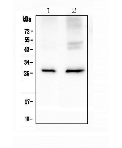 Western blot analysis of Aquaporin 5 using anti-Aquaporin 5 antibody (A03085). Electrophoresis was performed on a 5-20% SDS-PAGE gel at 70V (Stacking gel) / 90V (Resolving gel) for 2-3 hours. The sample well of each lane was loaded with 50ug of sample under reducing conditions. Lane 1: rat lung tissue lysates, Lane 2: mouse lung tissue lysates. After Electrophoresis, proteins were transferred to a Nitrocellulose membrane at 150mA for 50-90 minutes. Blocked the membrane with 5% Non-fat Milk/ TBS for 1.5 hour at RT. The membrane was incubated with rabbit anti-Aquaporin 5 antigen affinity purified polyclonal antibody (Catalog # A03085) at 0.5 μg/mL overnight at 4°C, then washed with TBS-0.1%Tween 3 times with 5 minutes each and probed with a goat anti-rabbit IgG-HRP secondary antibody at a dilution of 1:10000 for 1.5 hour at RT. The signal is developed using an Enhanced Chemiluminescent detection (ECL) kit (Catalog # EK1002) with Tanon 5200 system. A specific band was detected for Aquaporin 5 at approximately 28KD. The expected band size for Aquaporin 5 is at 28KD.