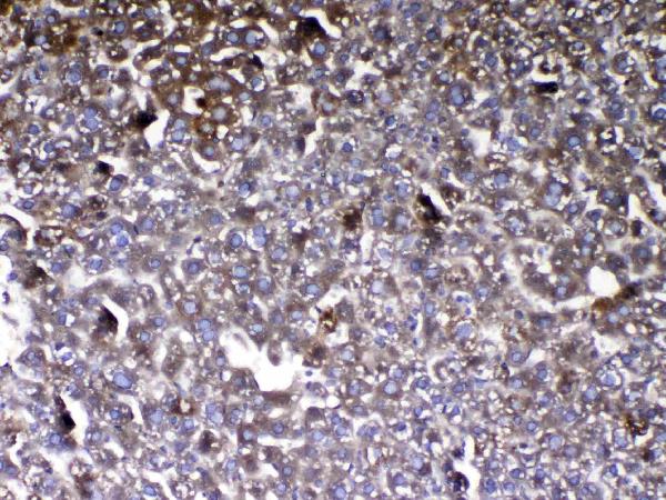 Figure 4. IHC analysis of Vitamin D Binding protein using anti-Vitamin D Binding protein antibody (A03364-1). Vitamin D Binding protein was detected in paraffin-embedded section of mouse liver tissue. Heat mediated antigen retrieval was performed in citrate buffer (pH6, epitope retrieval solution) for 20 mins. The tissue section was blocked with 10% goat serum. The tissue section was then incubated with 1ug/ml rabbit anti-Vitamin D Binding protein Antibody (A03364-1) overnight at 4 Biotinylated goat anti-rabbit IgG was used as secondary antibody and incubated for 30 minutes at 37 The tissue section was developed using Strepavidin-Biotin-Complex (SABC)(Catalog # SA1022) with DAB as the chromogen.