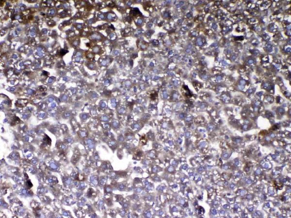 IHC analysis of Vitamin D Binding protein using anti-Vitamin D Binding protein antibody (A03364-1). Vitamin D Binding protein was detected in paraffin-embedded section of mouse liver tissue. Heat mediated antigen retrieval was performed in citrate buffer (pH6, epitope retrieval solution) for 20 mins. The tissue section was blocked with 10% goat serum. The tissue section was then incubated with 1ug/ml rabbit anti-Vitamin D Binding protein Antibody (A03364-1) overnight at 4 Biotinylated goat anti-rabbit IgG was used as secondary antibody and incubated for 30 minutes at 37 The tissue section was developed using Strepavidin-Biotin-Complex (SABC)(Catalog # SA1022) with DAB as the chromogen.