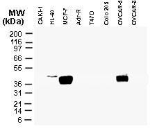 Western blot analysis of TUCAN/CARD8 in tumor cell lines using primary antibody dilution ratio of 1:2000. Cell lysates were normalized for total protein content. Western blot analysis of TUCAN/CARD8 in tumor cell lines using primary antibody dilution ratio of 1:2000. Cell lysates were normalized for total protein content.