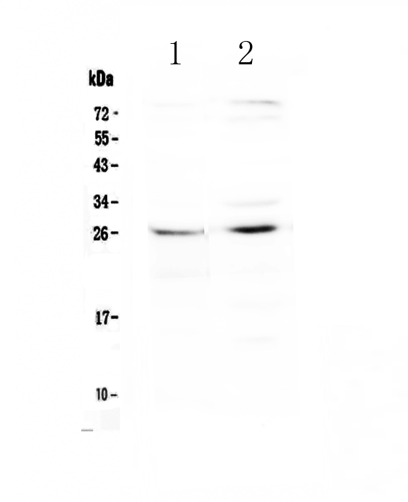 Western blot analysis of SLC31A1/CTR1 using anti-SLC31A1/CTR1 antibody (A03447-1).