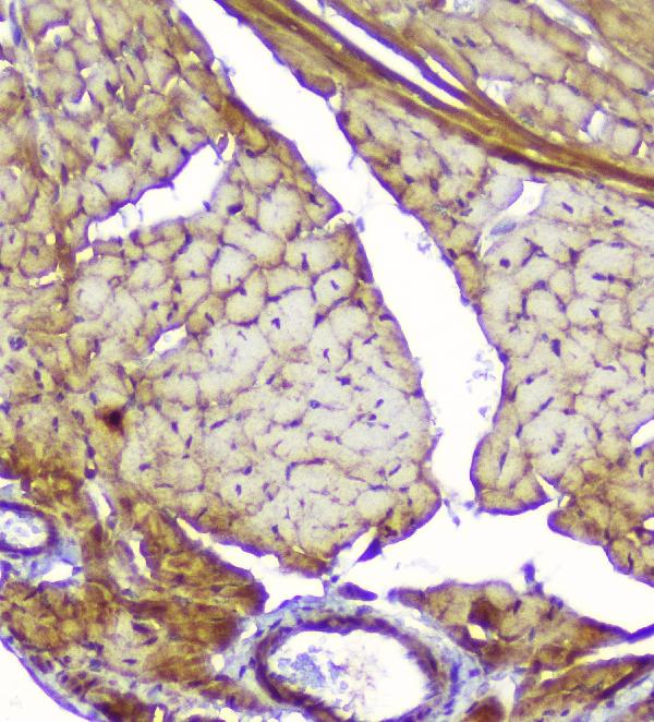 IHC analysis of Creatine Kinase MM using anti-Creatine Kinase MM antibody (A03452-1). Creatine Kinase MM was detected in paraffin-embedded section of mouse cardiac muscle tissue. Heat mediated antigen retrieval was performed in citrate buffer (pH6, epitope retrieval solution) for 20 mins. The tissue section was blocked with 10% goat serum. The tissue section was then incubated with 1μg/ml rabbit anti-Creatine Kinase MM Antibody (A03452-1) overnight at 4°C. Biotinylated goat anti-rabbit IgG was used as secondary antibody and incubated for 30 minutes at 37°C. The tissue section was developed using Strepavidin-Biotin-Complex (SABC)(Catalog # SA1022) with DAB as the chromogen.