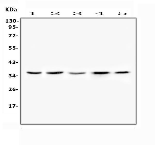  Western blot analysis of FRZB(SFRP3) using anti-FRZB(SFRP3) antibody (A03539-2)
