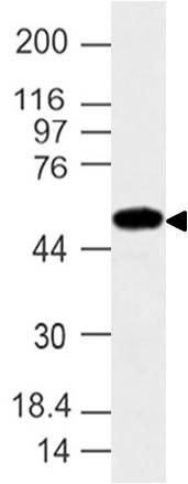 Western blot analysis of IFIT2