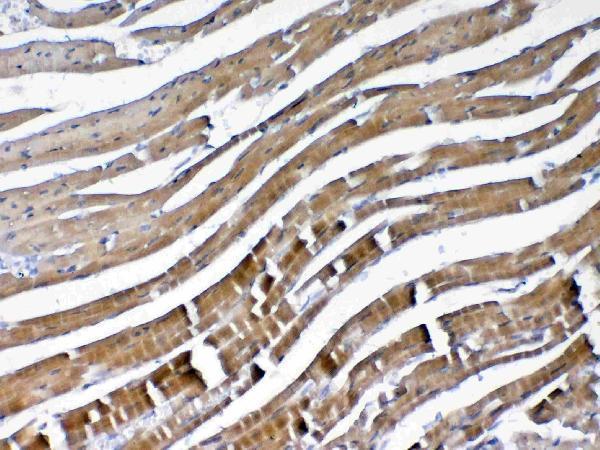 A04494 2 VEGFB primary antibodies IHC testing 2