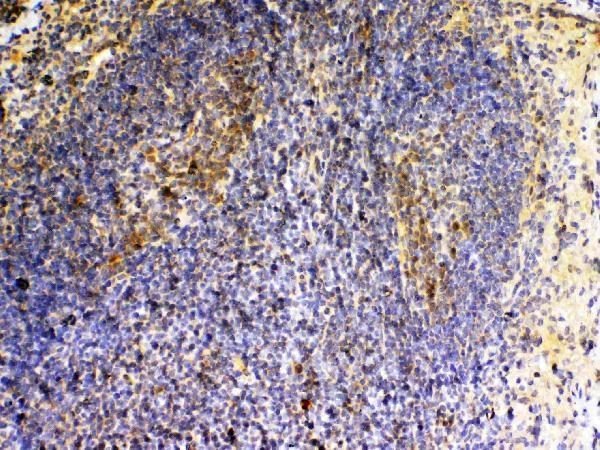 A04494 2 VEGFB primary antibodies IHC testing 3