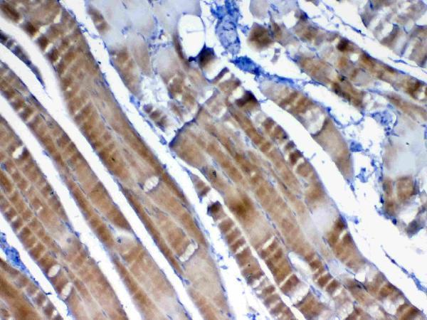 A04494 2 VEGFB primary antibodies IHC testing 4
