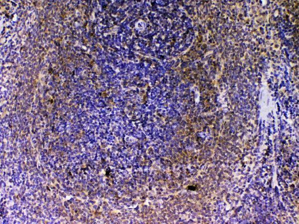 A04494 2 VEGFB primary antibodies IHC testing 5