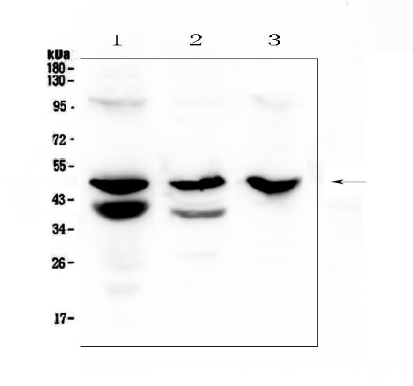 Western blot analysis of Cathepsin E using anti-Cathepsin E antibody (A04874-1). Electrophoresis was performed on a 5-20% SDS-PAGE gel at 70V (Stacking gel) / 90V (Resolving gel) for 2-3 hours. The sample well of each lane was loaded with 50ug of sample under reducing conditions. Lane 1: rat stomach tissue lysates, Lane 2: mouse stomach tissue lysates, Lane 3: mouse SP20 whole cell lysates. After Electrophoresis, proteins were transferred to a Nitrocellulose membrane at 150mA for 50-90 minutes. Blocked the membrane with 5% Non-fat Milk/ TBS for 1.5 hour at RT. The membrane was incubated with rabbit anti-Cathepsin E antigen affinity purified polyclonal antibody (Catalog # A04874-1) at 0.5 μg/mL overnight at 4℃, then washed with TBS-0.1%Tween 3 times with 5 minutes each and probed with a goat anti-rabbit IgG-HRP secondary antibody at a dilution of 1:10000 for 1.5 hour at RT. The signal is developed using an Enhanced Chemiluminescent detection (ECL) kit (Catalog # EK1002) with Tanon 5200 system. A specific band was detected for Cathepsin E at approximately 48KD. The expected band size for Cathepsin E is at 43KD.