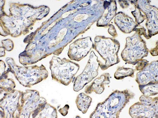 IHC analysis of MMP16 using anti-MMP16 antibody (A05065). MMP16 was detected in paraffin-embedded section of human placenta tissue. Heat mediated antigen retrieval was performed in citrate buffer (pH6, epitope retrieval solution) for 20 mins. The tissue section was blocked with 10% goat serum. The tissue section was then incubated with 1ug/ml rabbit anti-MMP16 Antibody (A05065) overnight at 4 Biotinylated goat anti-rabbit IgG was used as secondary antibody and incubated for 30 minutes at 37 The tissue section was developed using Strepavidin-Biotin-Complex (SABC)(Catalog # SA1022) with DAB as the chromogen.