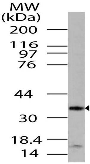 A05357 Western Blotting Analysis 1