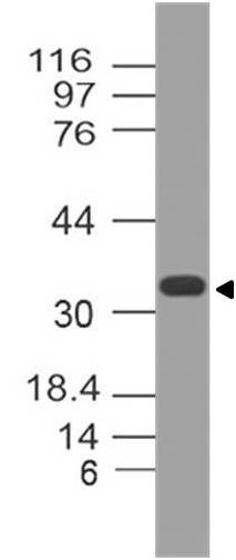 Western blot analysis of MTAP