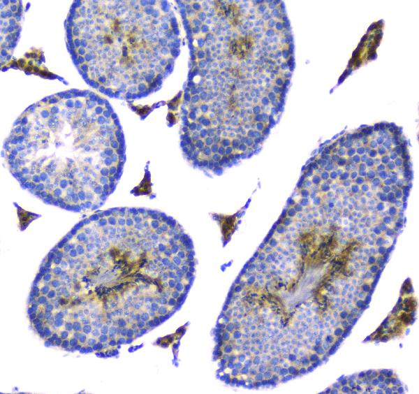 IHC analysis of Doppel using anti-Doppel antibody (A05457). Doppel was detected in paraffin-embedded section of mouse testis tissue. Heat mediated antigen retrieval was performed in citrate buffer (pH6, epitope retrieval solution) for 20 mins. The tissue section was blocked with 10% goat serum. The tissue section was then incubated with 1μg/ml rabbit anti-Doppel Antibody (A05457) overnight at 4°C. Biotinylated goat anti-rabbit IgG was used as secondary antibody and incubated for 30 minutes at 37°C. The tissue section was developed using Strepavidin-Biotin-Complex (SABC)(Catalog # SA1022) with DAB as the chromogen.