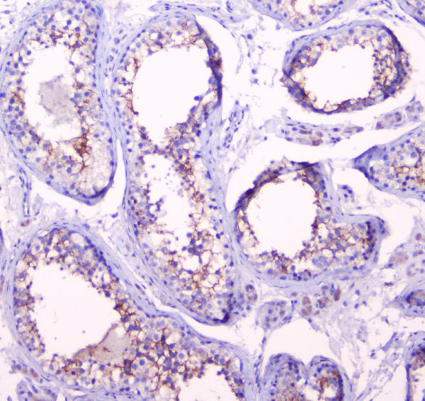 IHC analysis of Doppel using anti-Doppel antibody (A05457). Doppel was detected in paraffin-embedded section of human testis tissue. Heat mediated antigen retrieval was performed in citrate buffer (pH6, epitope retrieval solution) for 20 mins. The tissue section was blocked with 10% goat serum. The tissue section was then incubated with 1μg/ml rabbit anti-Doppel Antibody (A05457) overnight at 4°C. Biotinylated goat anti-rabbit IgG was used as secondary antibody and incubated for 30 minutes at 37°C. The tissue section was developed using Strepavidin-Biotin-Complex (SABC)(Catalog # SA1022) with DAB as the chromogen.