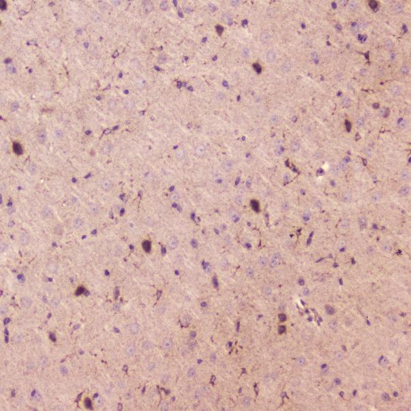 IHC analysis of SPARCL1 using anti-SPARCL1 antibody (A05726). SPARCL1 was detected in paraffin-embedded section of mouse brain tissue. Heat mediated antigen retrieval was performed in citrate buffer (pH6, epitope retrieval solution) for 20 mins. The tissue section was blocked with 10% goat serum. The tissue section was then incubated with 2μg/ml rabbit anti-SPARCL1 Antibody (A05726) overnight at 4℃. Biotinylated goat anti-rabbit IgG was used as secondary antibody and incubated for 30 minutes at 37℃. The tissue section was developed using Strepavidin-Biotin-Complex (SABC)(Catalog # SA1022) with DAB as the chromogen.