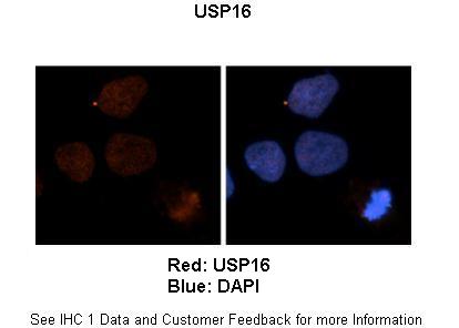 A05795 USP16 IHC test 1
