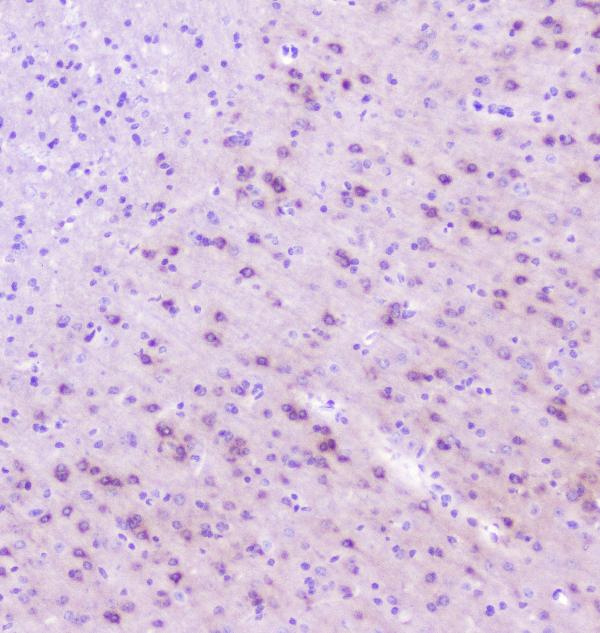 IHC analysis of RASAL1 using anti-RASAL1 antibody (A06423-2). RASAL1 was detected in paraffin-embedded section of mouse brain tissue. Heat mediated antigen retrieval was performed in citrate buffer (pH6, epitope retrieval solution) for 20 mins. The tissue section was blocked with 10% goat serum. The tissue section was then incubated with 1μg/ml rabbit anti-RASAL1 Antibody (A06423-2) overnight at 4°C. Biotinylated goat anti-rabbit IgG was used as secondary antibody and incubated for 30 minutes at 37°C. The tissue section was developed using Strepavidin-Biotin-Complex (SABC)(Catalog # SA1022) with DAB as the chromogen.