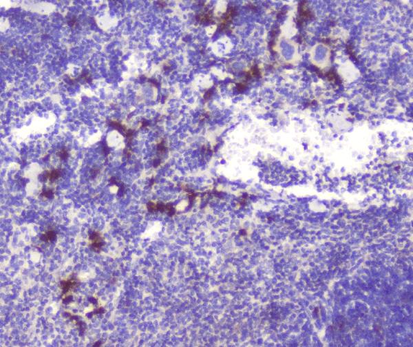 IHC analysis of RASAL1 using anti-RASAL1 antibody (A06423-2). RASAL1 was detected in paraffin-embedded section of mouse spleen tissue. Heat mediated antigen retrieval was performed in citrate buffer (pH6, epitope retrieval solution) for 20 mins. The tissue section was blocked with 10% goat serum. The tissue section was then incubated with 1μg/ml rabbit anti-RASAL1 Antibody (A06423-2) overnight at 4°C. Biotinylated goat anti-rabbit IgG was used as secondary antibody and incubated for 30 minutes at 37°C. The tissue section was developed using Strepavidin-Biotin-Complex (SABC)(Catalog # SA1022) with DAB as the chromogen.