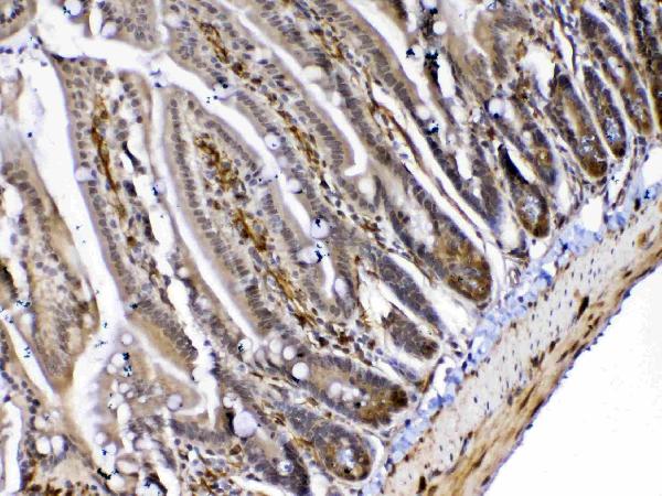 IHC analysis of MED4 using anti-MED4 antibody (A06467-1). MED4 was detected in paraffin-embedded section of mouse small intestine tissue. Heat mediated antigen retrieval was performed in citrate buffer (pH6, epitope retrieval solution) for 20 mins. The tissue section was blocked with 10% goat serum. The tissue section was then incubated with 1ug/ml rabbit anti-MED4 Antibody (A06467-1) overnight at 4 Biotinylated goat anti-rabbit IgG was used as secondary antibody and incubated for 30 minutes at 37 The tissue section was developed using Strepavidin-Biotin-Complex (SABC)(Catalog # SA1022) with DAB as the chromogen.