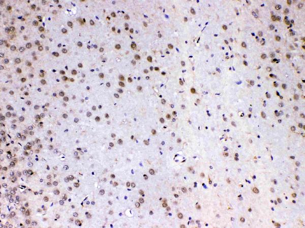 IHC analysis of MED4 using anti-MED4 antibody (A06467-1). MED4 was detected in paraffin-embedded section of rat brain tissue. Heat mediated antigen retrieval was performed in citrate buffer (pH6, epitope retrieval solution) for 20 mins. The tissue section was blocked with 10% goat serum. The tissue section was then incubated with 1ug/ml rabbit anti-MED4 Antibody (A06467-1) overnight at 4 Biotinylated goat anti-rabbit IgG was used as secondary antibody and incubated for 30 minutes at 37 The tissue section was developed using Strepavidin-Biotin-Complex (SABC)(Catalog # SA1022) with DAB as the chromogen.