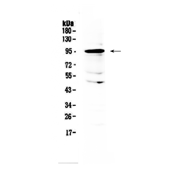 Western blot analysis of AMOTL2 using anti-AMOTL2 antibody (A06852). Electrophoresis was performed on a 5-20% SDS-PAGE gel at 70V (Stacking gel) / 90V (Resolving gel) for 2-3 hours. The sample well of each lane was loaded with 50ug of sample under reducing conditions. Lane 1: human placenta tissue lysates. After Electrophoresis, proteins were transferred to a Nitrocellulose membrane at 150mA for 50-90 minutes. Blocked the membrane with 5% Non-fat Milk/ TBS for 1.5 hour at RT. The membrane was incubated with rabbit anti-AMOTL2 antigen affinity purified polyclonal antibody (Catalog # A06852) at 0.5 μg/mL overnight at 4°C, then washed with TBS-0.1%Tween 3 times with 5 minutes each and probed with a goat anti-rabbit IgG-HRP secondary antibody at a dilution of 1:10000 for 1.5 hour at RT. The signal is developed using an Enhanced Chemiluminescent detection (ECL) kit (Catalog # EK1002) with Tanon 5200 system. A specific band was detected for AMOTL2 at approximately 95KD. The expected band size for AMOTL2 is at 86KD.