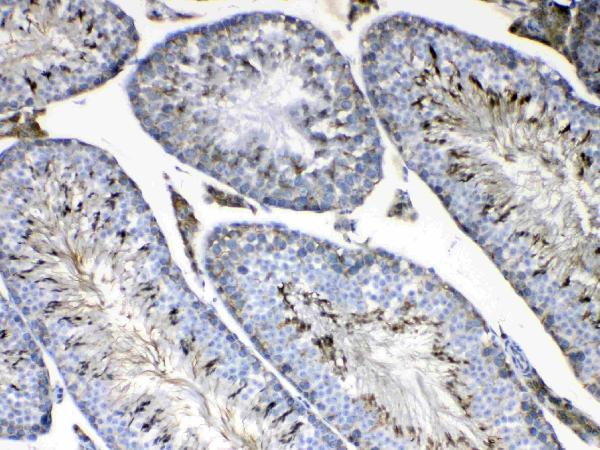 IHC analysis of FMN1 using anti-FMN1 antibody (A07520). FMN1 was detected in paraffin-embedded section of mouse testis tissue. Heat mediated antigen retrieval was performed in citrate buffer (pH6, epitope retrieval solution) for 20 mins. The tissue section was blocked with 10% goat serum. The tissue section was then incubated with 1μg/ml rabbit anti-FMN1 Antibody (A07520) overnight at 4°C. Biotinylated goat anti-rabbit IgG was used as secondary antibody and incubated for 30 minutes at 37°C. The tissue section was developed using Strepavidin-Biotin-Complex (SABC)(Catalog # SA1022) with DAB as the chromogen.