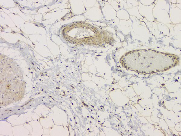 IHC analysis of SRCIN1 using anti-SRCIN1 antibody (A08110-1). SRCIN1 was detected in paraffin-embedded section of human appendicitis tissue. Heat mediated antigen retrieval was performed in citrate buffer (pH6, epitope retrieval solution) for 20 mins. The tissue section was blocked with 10% goat serum. The tissue section was then incubated with 1μg/ml rabbit anti-SRCIN1 Antibody (A08110-1) overnight at 4°C. Biotinylated goat anti-rabbit IgG was used as secondary antibody and incubated for 30 minutes at 37°C. The tissue section was developed using Strepavidin-Biotin-Complex (SABC)(Catalog # SA1022) with DAB as the chromogen.