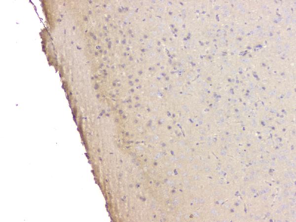 IHC analysis of SRCIN1 using anti-SRCIN1 antibody (A08110-1). SRCIN1 was detected in paraffin-embedded section of mouse brain tissue. Heat mediated antigen retrieval was performed in citrate buffer (pH6, epitope retrieval solution) for 20 mins. The tissue section was blocked with 10% goat serum. The tissue section was then incubated with 1μg/ml rabbit anti-SRCIN1 Antibody (A08110-1) overnight at 4°C. Biotinylated goat anti-rabbit IgG was used as secondary antibody and incubated for 30 minutes at 37°C. The tissue section was developed using Strepavidin-Biotin-Complex (SABC)(Catalog # SA1022) with DAB as the chromogen.