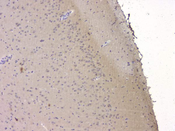 IHC analysis of SRCIN1 using anti-SRCIN1 antibody (A08110-1). SRCIN1 was detected in paraffin-embedded section of rat brain tissue. Heat mediated antigen retrieval was performed in citrate buffer (pH6, epitope retrieval solution) for 20 mins. The tissue section was blocked with 10% goat serum. The tissue section was then incubated with 1μg/ml rabbit anti-SRCIN1 Antibody (A08110-1) overnight at 4°C. Biotinylated goat anti-rabbit IgG was used as secondary antibody and incubated for 30 minutes at 37°C. The tissue section was developed using Strepavidin-Biotin-Complex (SABC)(Catalog # SA1022) with DAB as the chromogen.