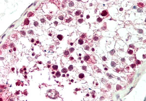 Immunohistochemical analysis of TOX