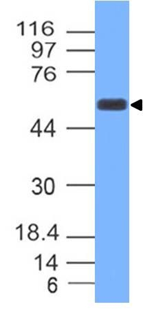 Western blot analysis of TOX
