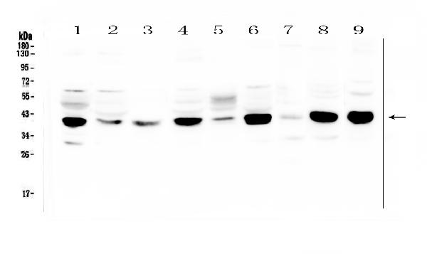 Western blot analysis of MCUR1 using anti-MCUR1 antibody (A08547-1). Electrophoresis was performed on a 5-20% SDS-PAGE gel at 70V (Stacking gel) / 90V (Resolving gel) for 2-3 hours. The sample well of each lane was loaded with 50ug of sample under reducing conditions. Lane 1: human Hela whole cell lysates. Lane 2: human MDA-MB-231 whole cell lysates, Lane 3: human HL-60 whole cell lysates, Lane 4: human MDA-MB-453 whole cell lysates, Lane 5: human A431 whole cell lysates, Lane 6: human Caco-2 whole cell lysates, Lane 7: rat spleen tissue lysates, Lane 8: mouse lung tissue lysates, Lane 9: mouse Ana-1 whole cell lysates, After Electrophoresis, proteins were transferred to a Nitrocellulose membrane at 150mA for 50-90 minutes. Blocked the membrane with 5% Non-fat Milk/ TBS for 1.5 hour at RT. The membrane was incubated with rabbit anti-MCUR1 antigen affinity purified polyclonal antibody (Catalog # A08547-1) at 0.5 μg/mL overnight at 4°C, then washed with TBS-0.1%Tween 3 times with 5 minutes each and probed with a goat anti-rabbit IgG-HRP secondary antibody at a dilution of 1:10000 for 1.5 hour at RT. The signal is developed using an Enhanced Chemiluminescent detection (ECL) kit (Catalog # EK1002) with Tanon 5200 system. A specific band was detected for MCUR1 at approximately 40KD. The expected band size for MCUR1 is at 40KD.