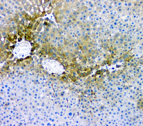 IHC analysis of RMI2 using anti-RMI2 antibody (A08685). RMI2 was detected in paraffin-embedded section of rat liver tissue. Heat mediated antigen retrieval was performed in citrate buffer (pH6, epitope retrieval solution) for 20 mins. The tissue section was blocked with 10% goat serum. The tissue section was then incubated with 1μg/ml rabbit anti-RMI2 Antibody (A08685) overnight at 4°C. Biotinylated goat anti-rabbit IgG was used as secondary antibody and incubated for 30 minutes at 37°C. The tissue section was developed using Strepavidin-Biotin-Complex (SABC)(Catalog # SA1022) with DAB as the chromogen.