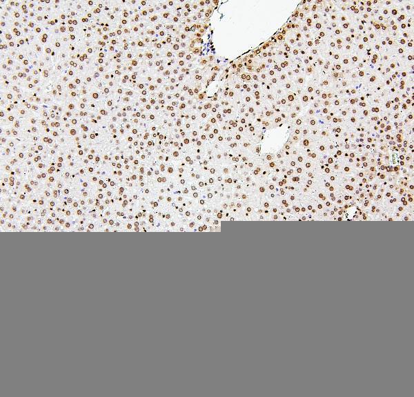 A08821 1 H1F0 primary antibodies IHC testing 11