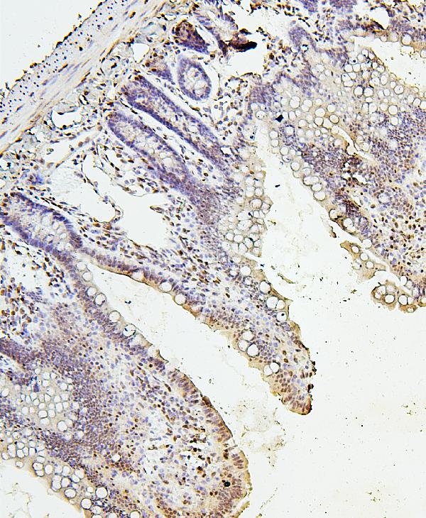 Figure 7. IHC analysis of H1F0 using anti-H1F0 antibody (A08821-1). H1F0 was detected in paraffin-embedded section of rat small intestine tissues. Heat mediated antigen retrieval was performed in citrate buffer (pH6, epitope retrieval solution) for 20 mins. The tissue section was blocked with 10% goat serum. The tissue section was then incubated with 1microg/ml rabbit anti-H1F0 Antibody (A08821-1) overnight at 4°C. Biotinylated goat anti-rabbit IgG was used as secondary antibody and incubated for 30 minutes at 37°C. The tissue section was developed using Strepavidin-Biotin-Complex (SABC)(Catalog # SA1022) with DAB as the chromogen.