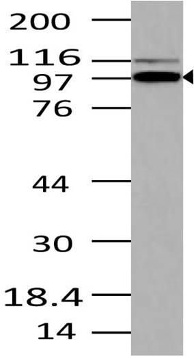 A09398 Western Blotting Analysis 1