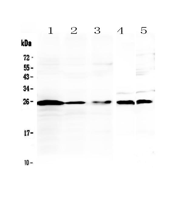 Figure 1. Western blot analysis of IL36 alpha using anti-IL36 alpha antibody (A09802-1). Electrophoresis was performed on a 5-20% SDS-PAGE gel at 70V (Stacking gel) / 90V (Resolving gel) for 2-3 hours. The sample well of each lane was loaded with 50ug of sample under reducing conditions. Lane 1: human Jurkat whole cell lysates, Lane 2: human K562 whole cell lysates, Lane 3: human Raji whole cell lysates, Lane 4: rat thymus tissue lysates, Lane 5: mouse thymus tissue lysates. After Electrophoresis, proteins were transferred to a Nitrocellulose membrane at 150mA for 50-90 minutes. Blocked the membrane with 5% Non-fat Milk/ TBS for 1.5 hour at RT. The membrane was incubated with rabbit anti-IL36 alpha antigen affinity purified polyclonal antibody (Catalog # A09802-1) at 0.5 ug/mL overnight at 4 then washed with TBS-0.1%Tween 3 times with 5 minutes each and probed with a goat anti-rabbit IgG-HRP secondary antibody at a dilution of 1:10000 for 1.5 hour at RT. The signal is developed using an Enhanced Chemiluminescent detection (ECL) kit (Catalog # EK1002) with Tanon 5200 system. A specific band was detected for IL36 alpha at approximately 25KD. The expected band size for IL36 alpha is at 17KD.