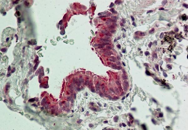 A10216 Immunostaining Analysis 11 8012 Lung_ Respiratory Epithelium 882671