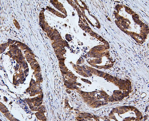 A10407 1 RNF169 primary antibodies IHC testing 2