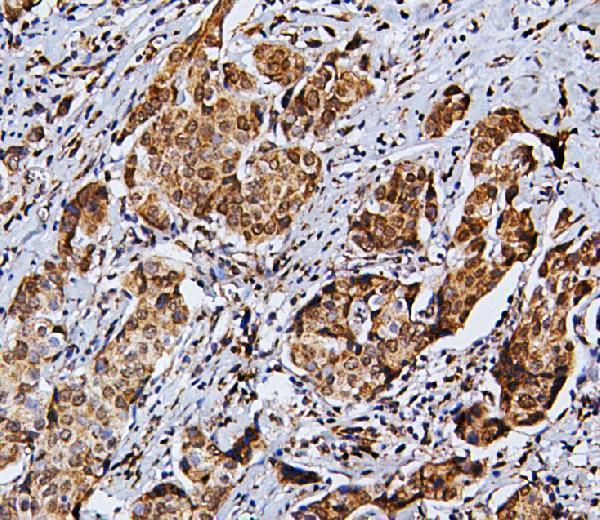 A10407 1 RNF169 primary antibodies IHC testing 3