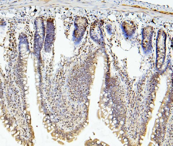 A10407 1 RNF169 primary antibodies IHC testing 5