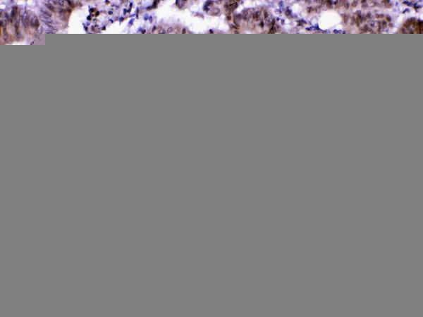 A10600 2 MED18 primary antibodies IHC testing 2