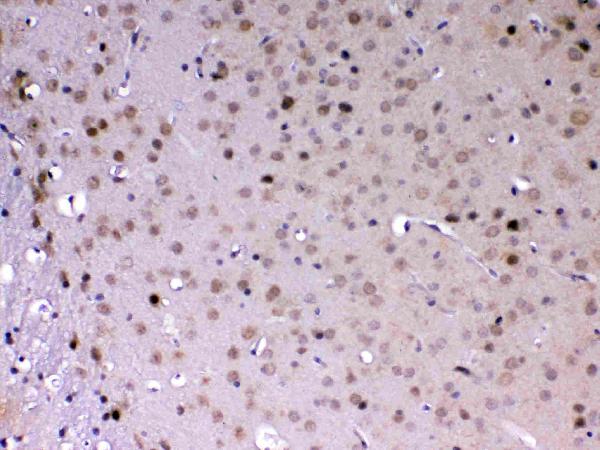 IHC analysis of MED18 using anti-MED18 antibody (A10600-2). MED18 was detected in paraffin-embedded section of mouse brain tissue. Heat mediated antigen retrieval was performed in citrate buffer (pH6, epitope retrieval solution) for 20 mins. The tissue section was blocked with 10% goat serum. The tissue section was then incubated with 1ug/ml rabbit anti-MED18 Antibody (A10600-2) overnight at 4 Biotinylated goat anti-rabbit IgG was used as secondary antibody and incubated for 30 minutes at 37 The tissue section was developed using Strepavidin-Biotin-Complex (SABC)(Catalog # SA1022) with DAB as the chromogen.