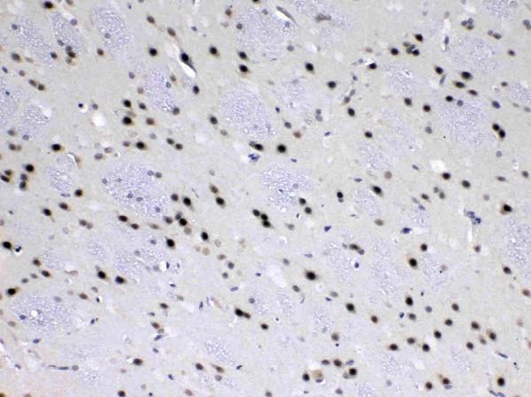 A10600 2 MED18 primary antibodies IHC testing 6
